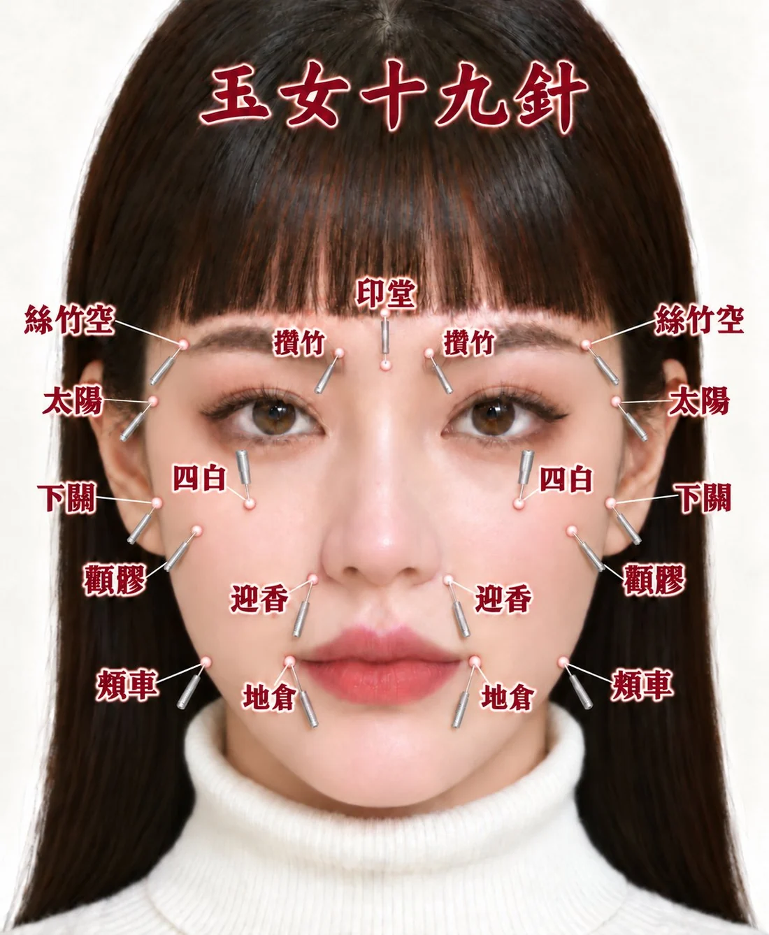 玉女十九針的面部穴位與進針方向示意