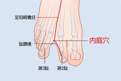 內庭穴定位：第 2、3 趾間，趾蹼緣後方赤白肉際